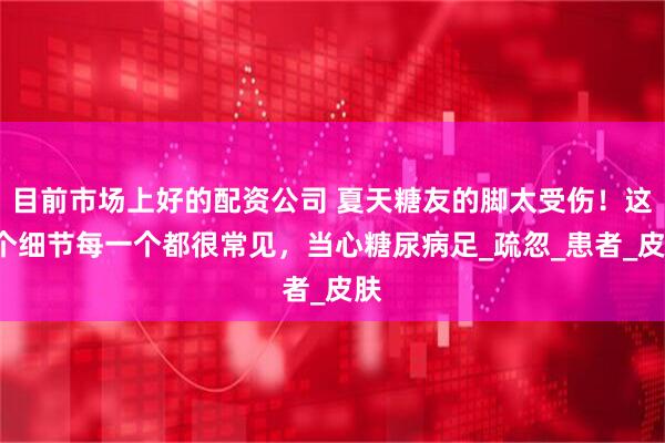 目前市场上好的配资公司 夏天糖友的脚太受伤！这5个细节每一个都很常见，当心糖尿病足_疏忽_患者_皮肤